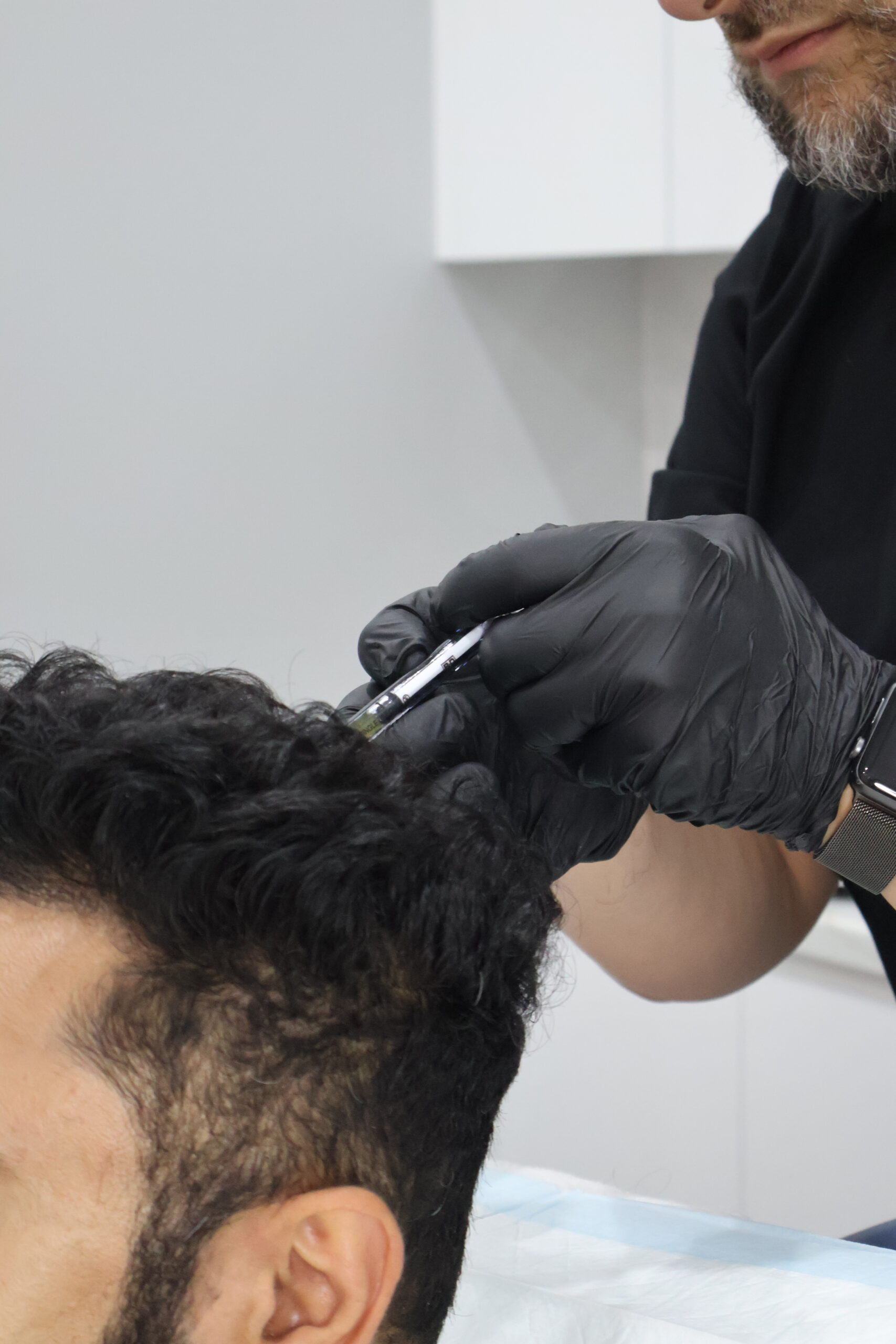 PRP Hair Treatment Revesby