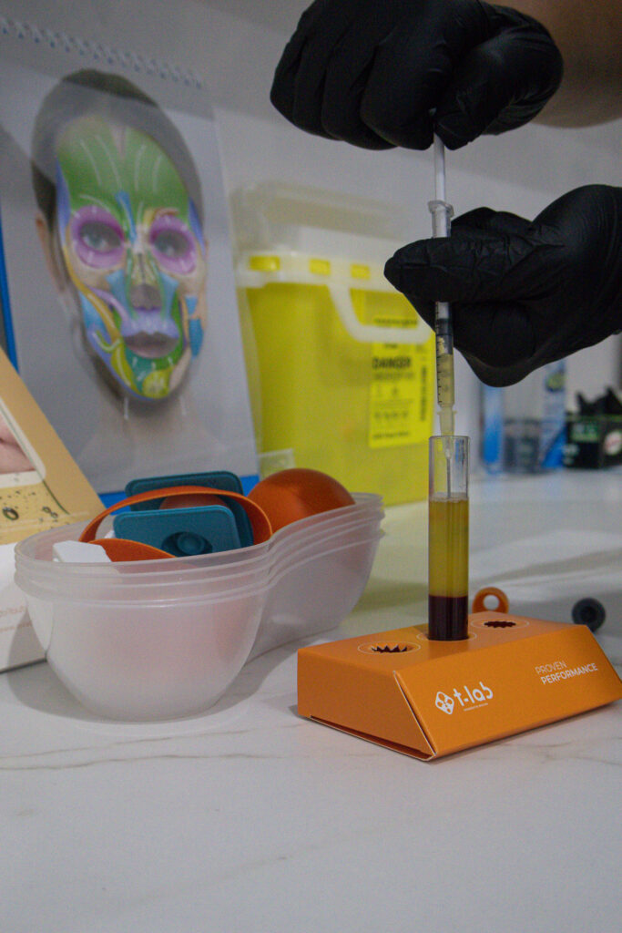 platelet-rich-plasma